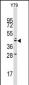 LAMP2 Antibody (C-term)